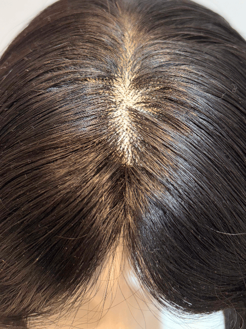 Hair Extensions Luxe Hair Loss Solution Luxury Silk Top Human Hair Wig – Most Natural Scalp Look